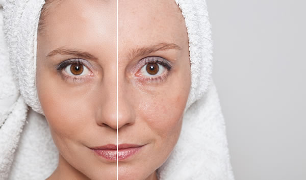 PDO-COQ Treads Facial Skin Tightening Firming Cyprus Derma Clinic Yiannis Neophytou