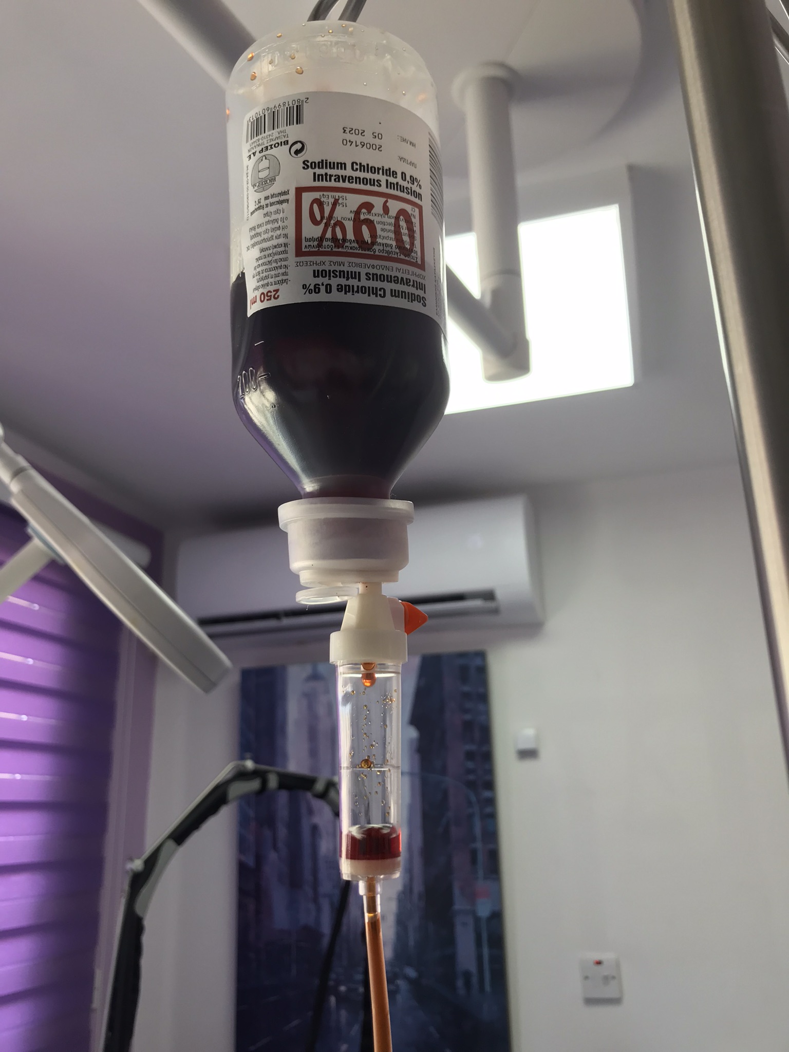 Intravenous iron infusion