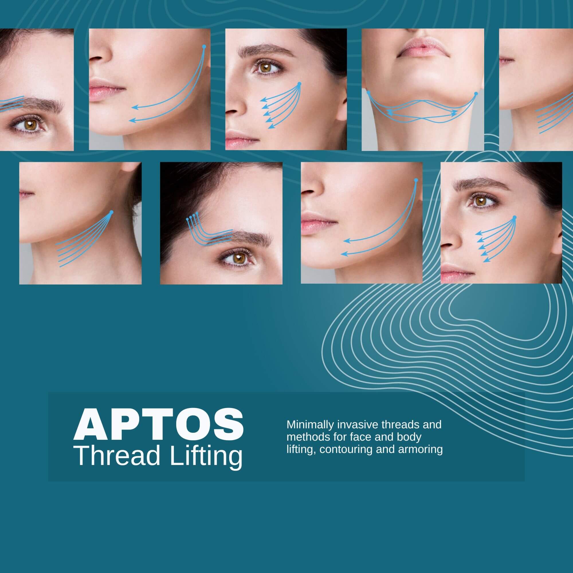 Aptos_Thread_Lifting