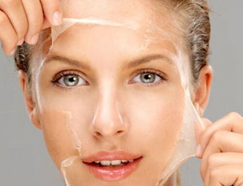 Chemical Peeling or Chemical Exfoliation